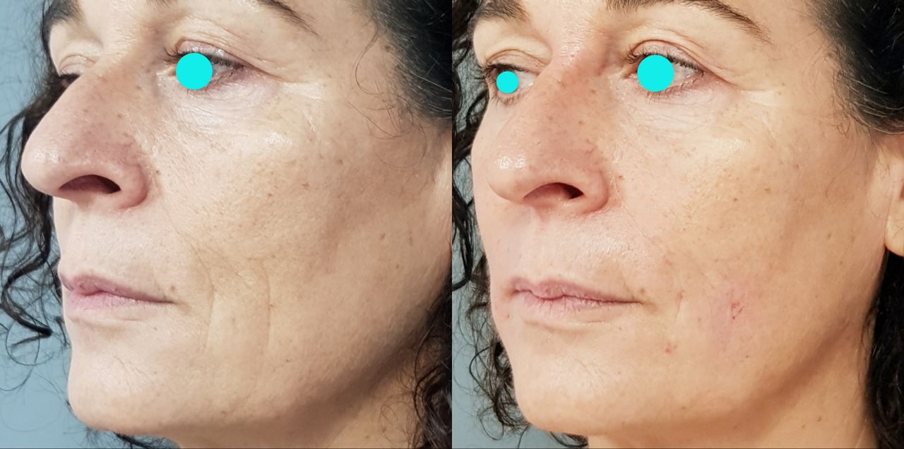 Rosalba Herrero Zerpa-6