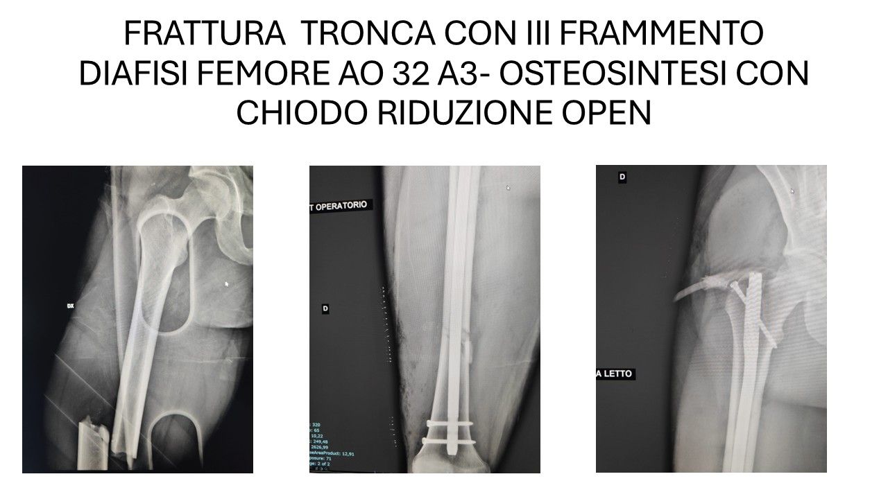 Bartolomeo D'amora-4