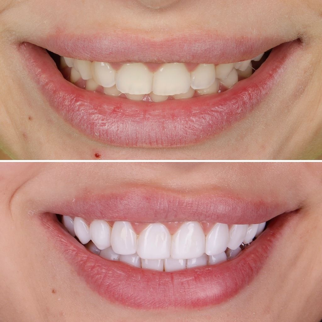 Magdalena Gruszczyńska-6