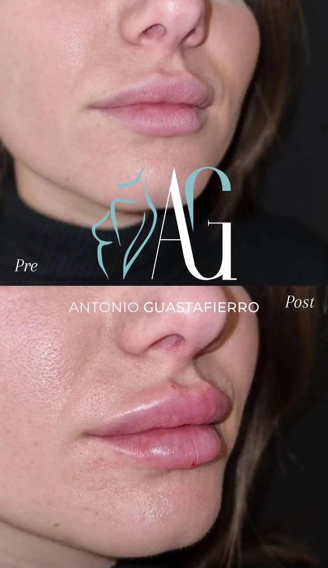 Antonio Guastafierro-11