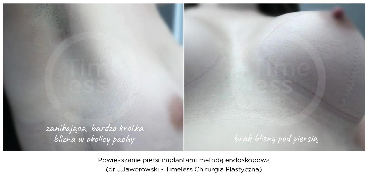 Janusz Jaworowski-111