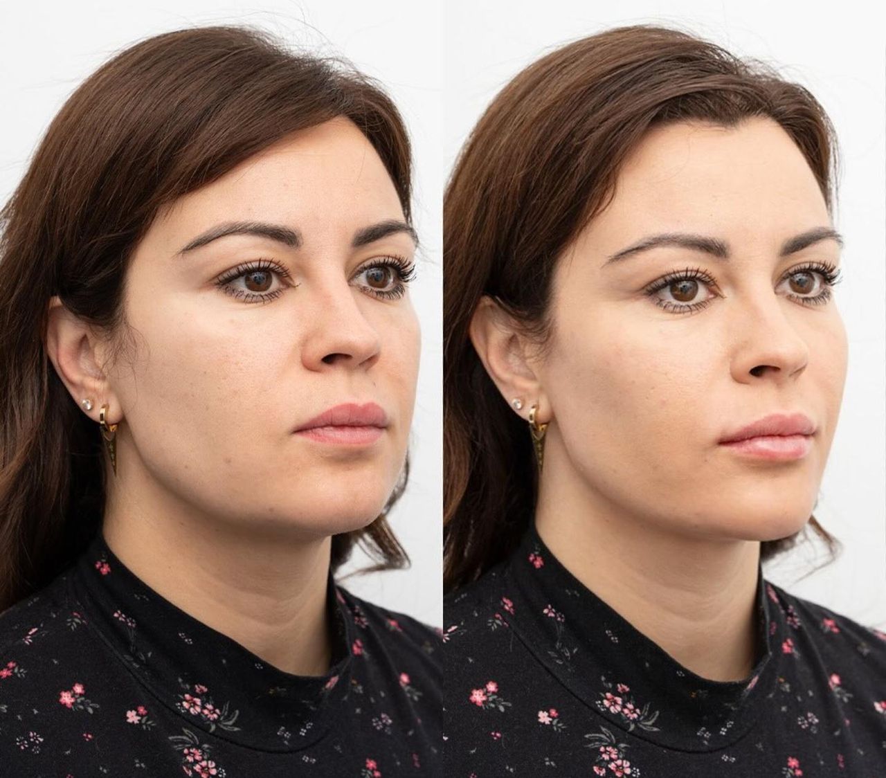 Raquel Moreno Pentinel-78