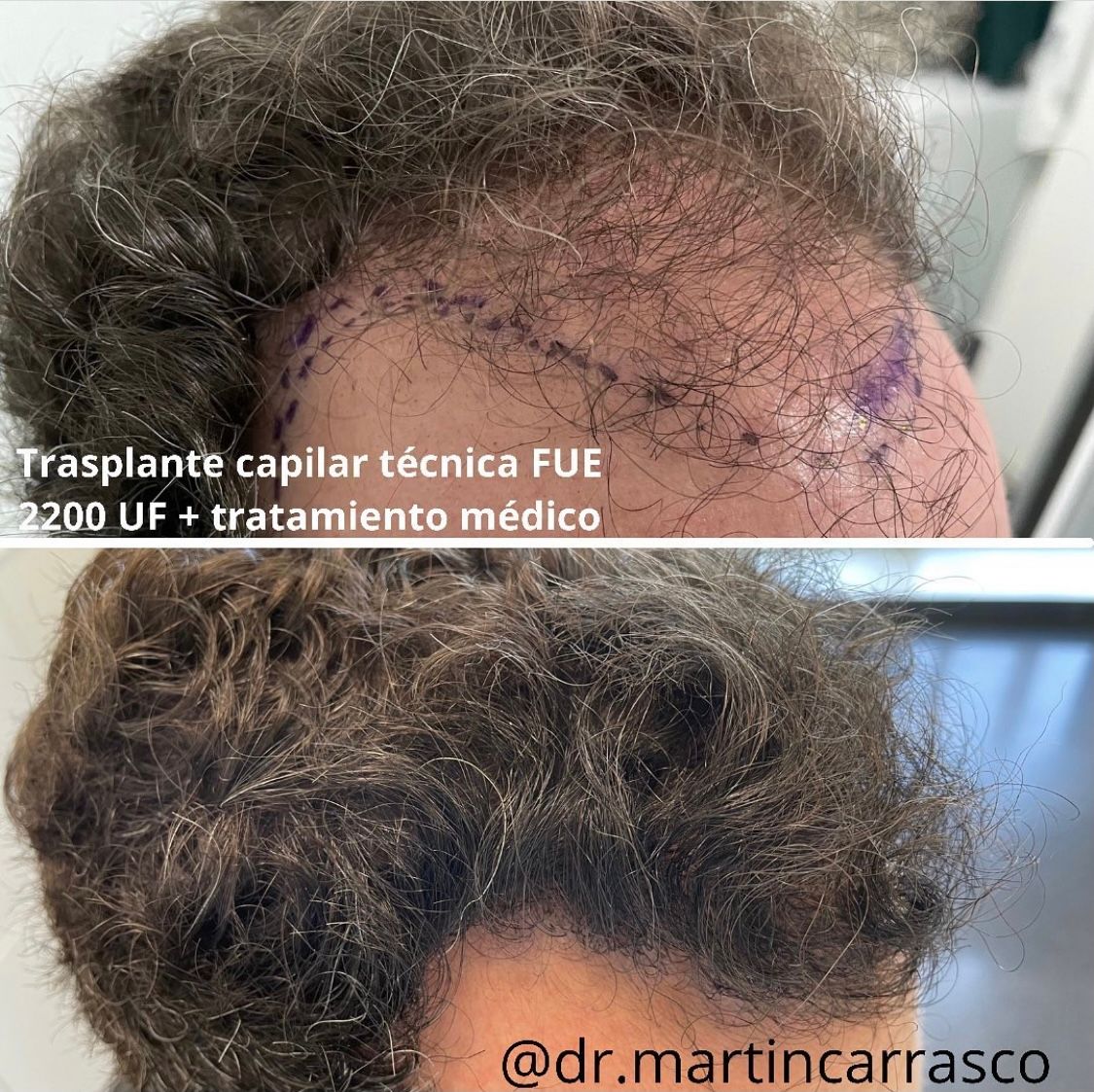 Pablo Martín Carrasco-6