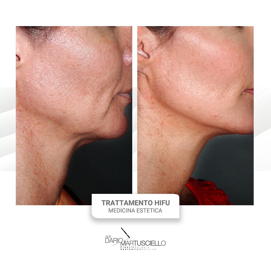 Dario Martusciello-10