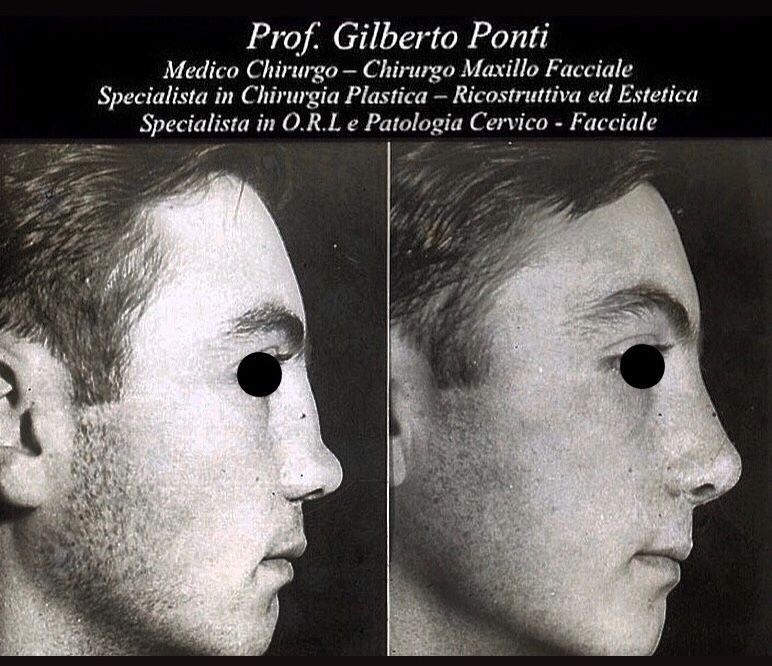 Gilberto Ponti-18