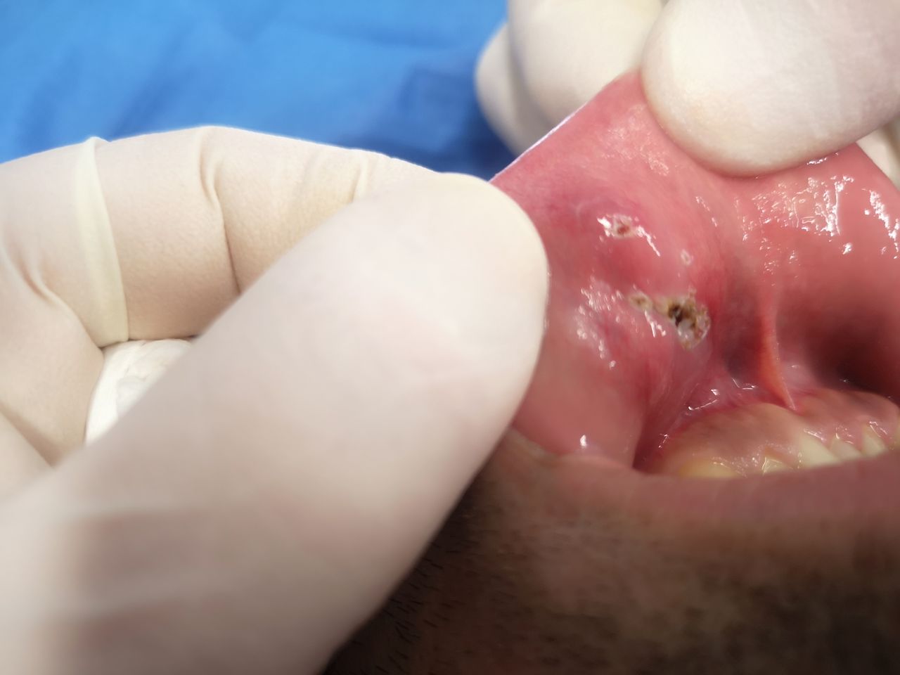 Stefano De Simone-110