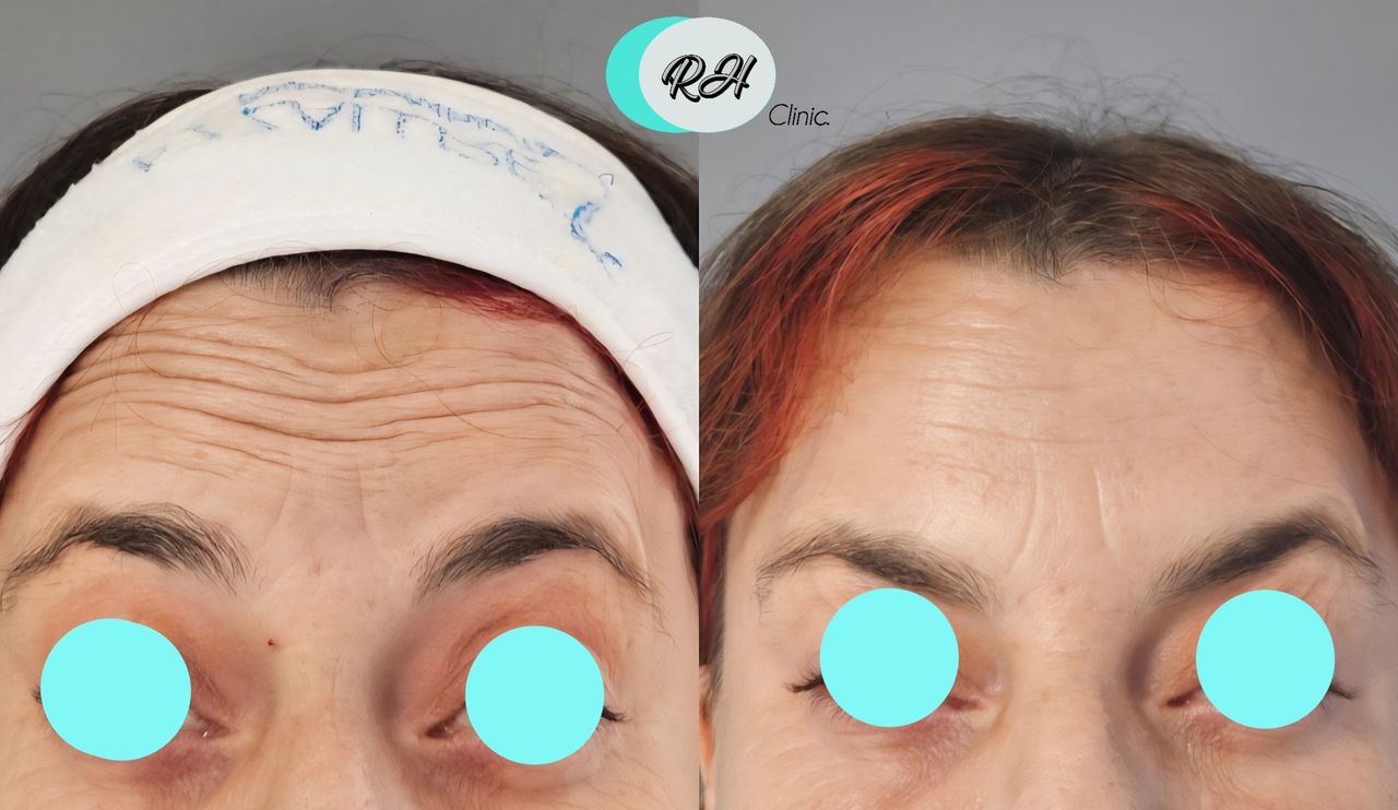 Rosalba Herrero Zerpa-595