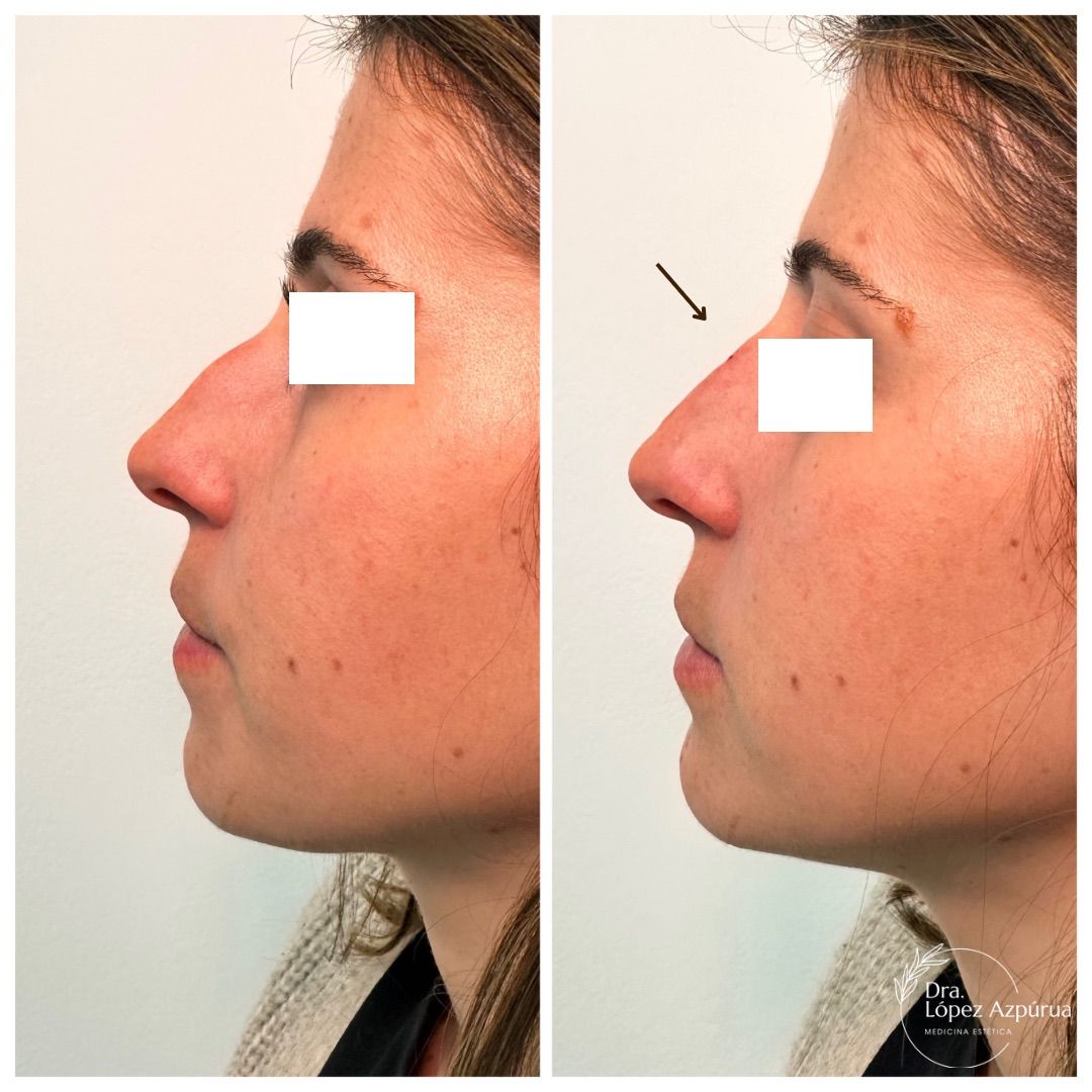 Alexandra López Azpúrua-5