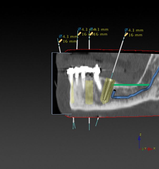 Alessandro Palumbo-15