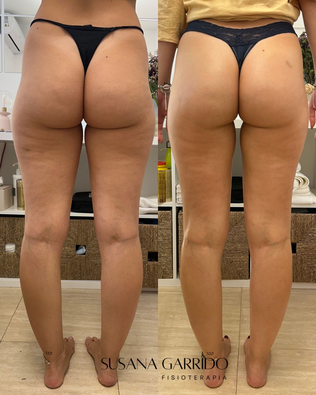 Susana Garrido De Las Heras-6