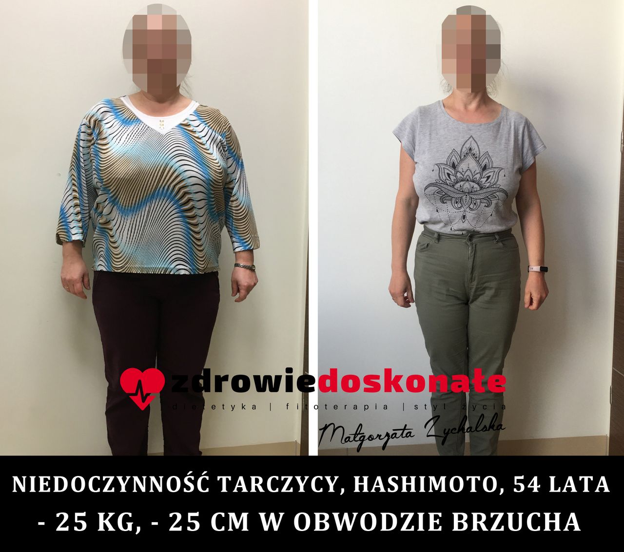 Małgorzata Zychalska-56