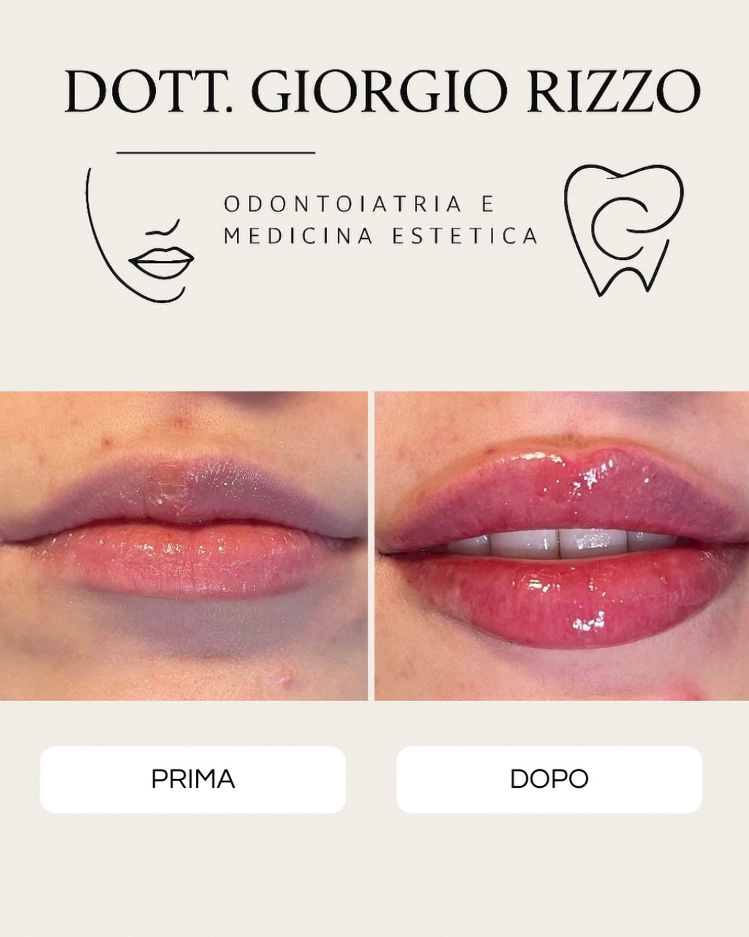 Giorgio Rizzo-23