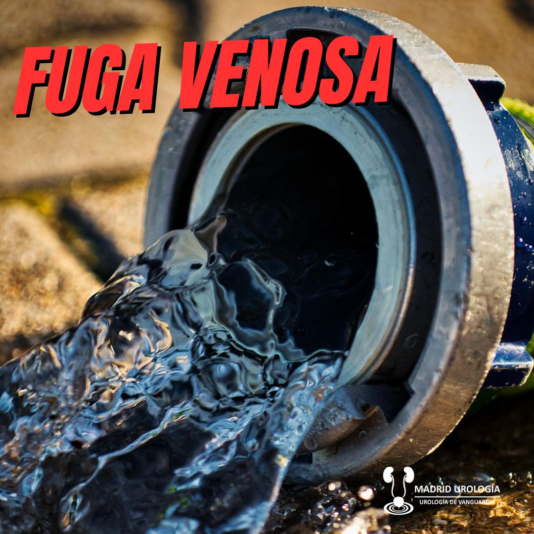 Luis Fernando Susaníbar Napurí-87