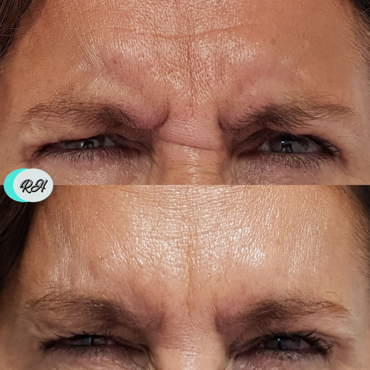 Rosalba Herrero Zerpa-103