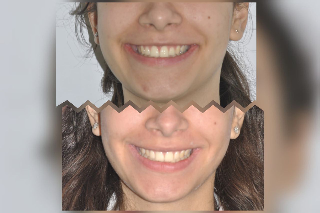 Gianluca Del Vecchio-189