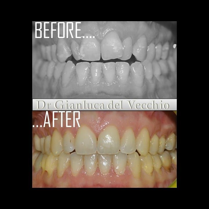 Gianluca Del Vecchio-44