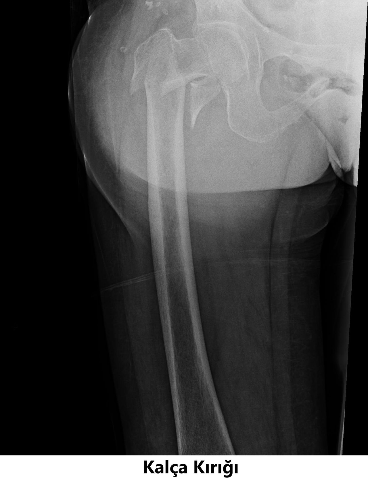 Javid M. Azarabadı-6