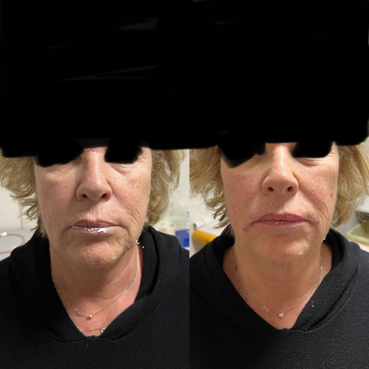 Jacopo Pettinelli-23