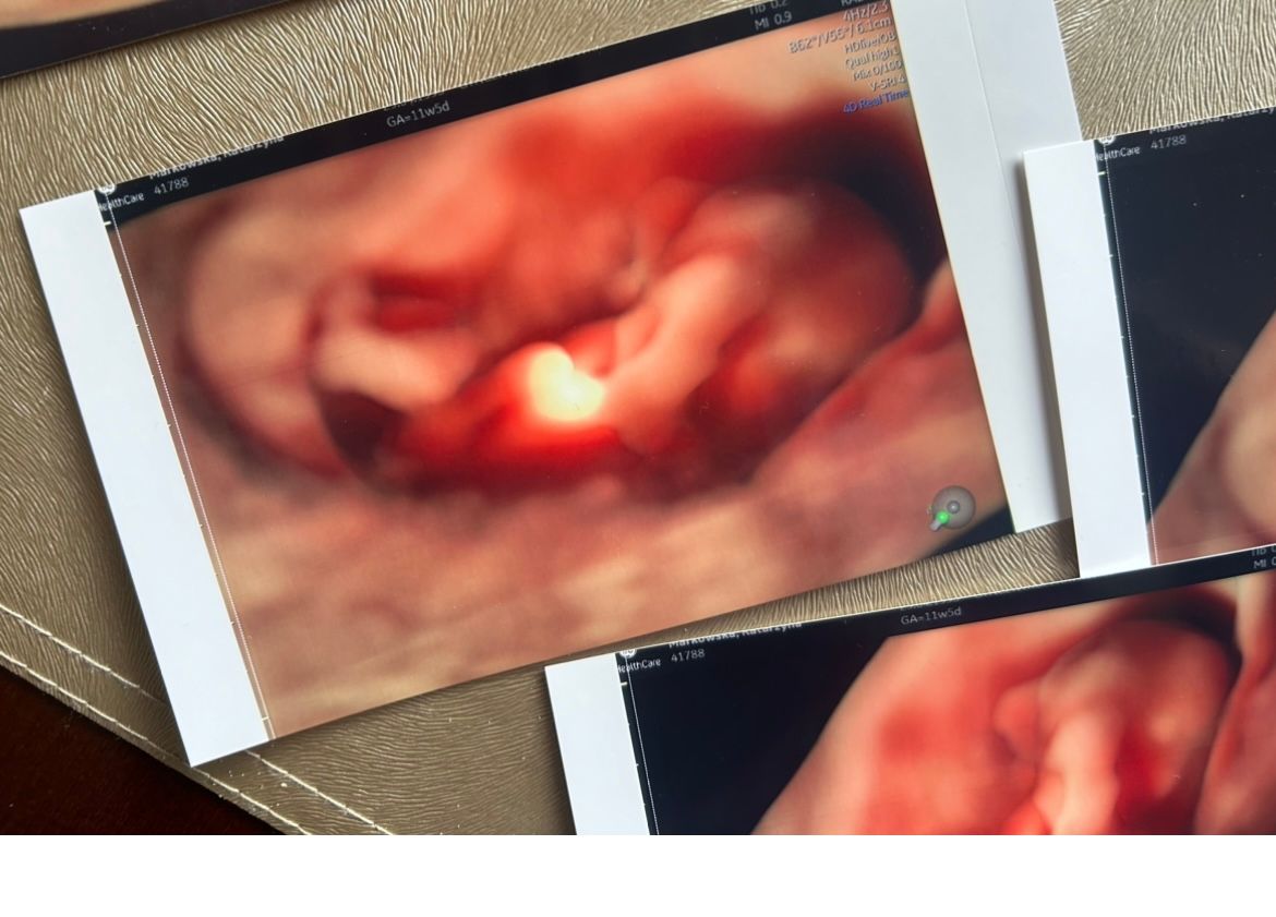 Wioletta Rozmus-Warcholińska-137