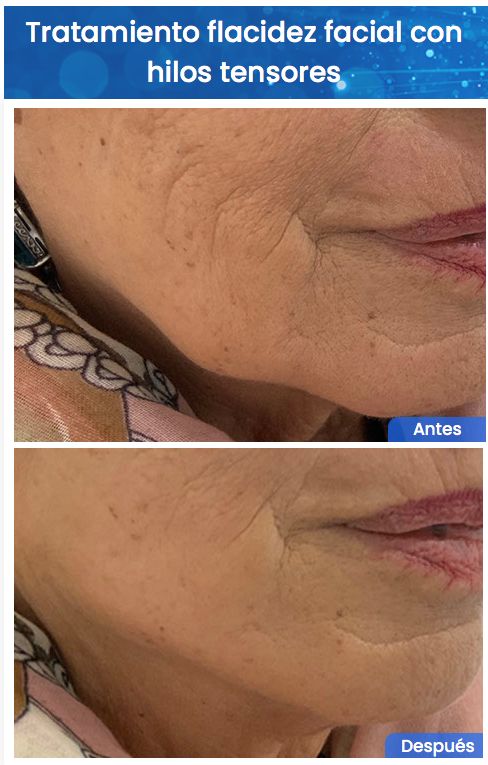 Juan Enrique Pérez Enríquez-143