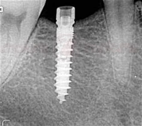 Klaus Telgenkämper-2