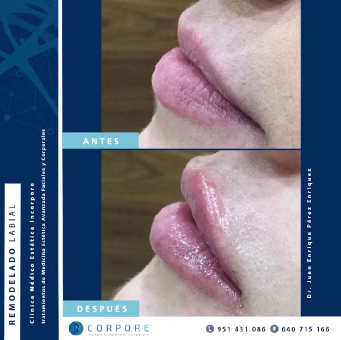 Juan Enrique Pérez Enríquez-118