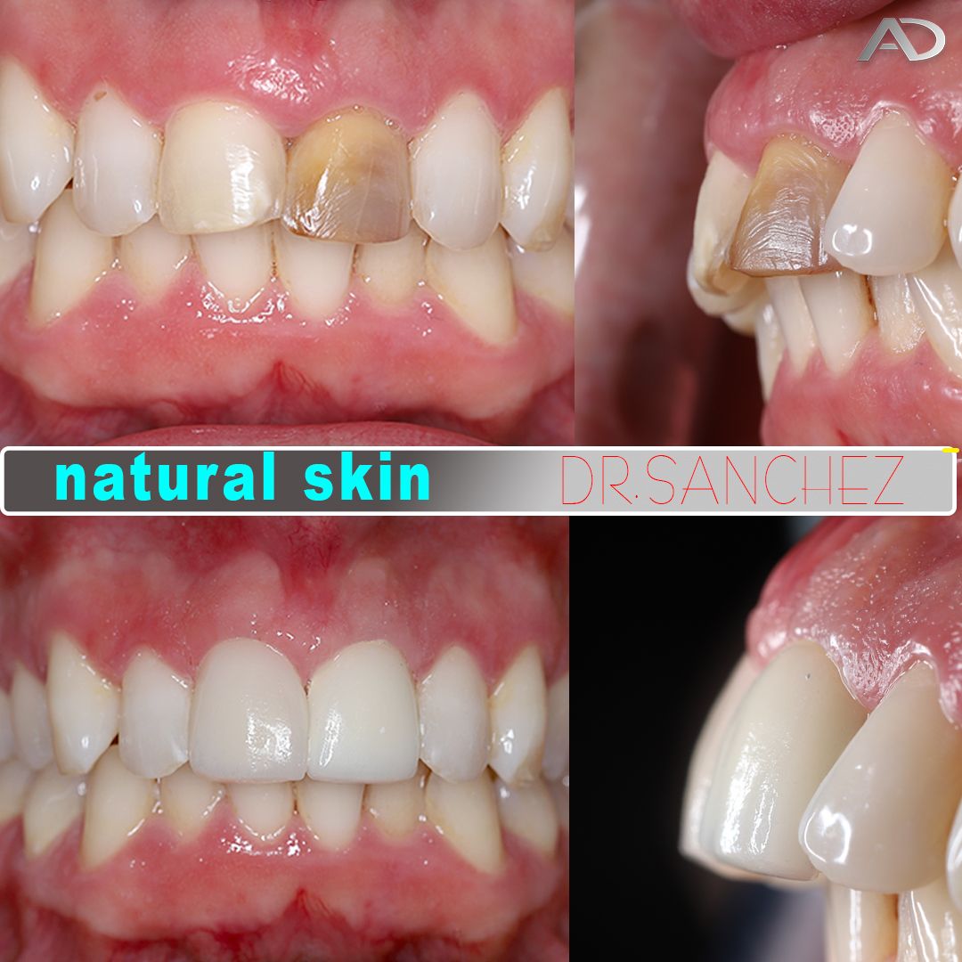 Juan Carlos Sánchez Pérez-33