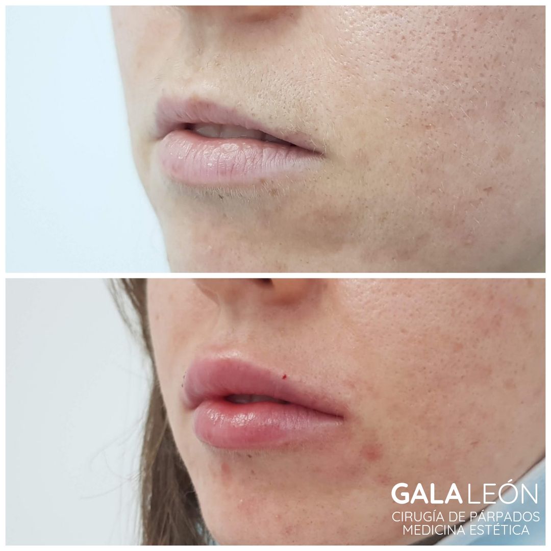 Gala P. Leon Salvatierra-5