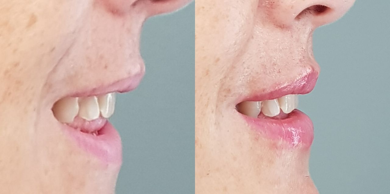 Rosalba Herrero Zerpa-168