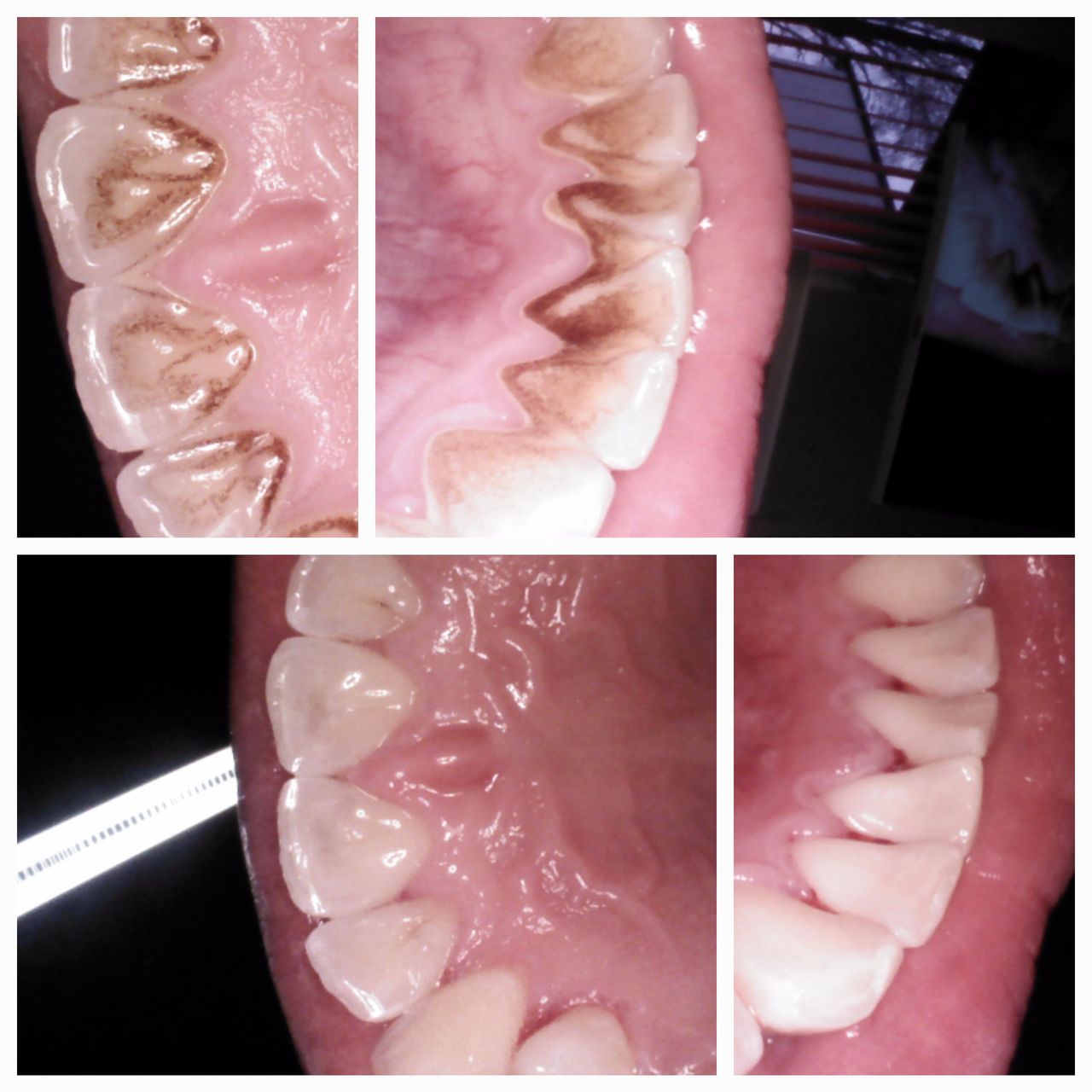 Katarzyna  Kmieć -5