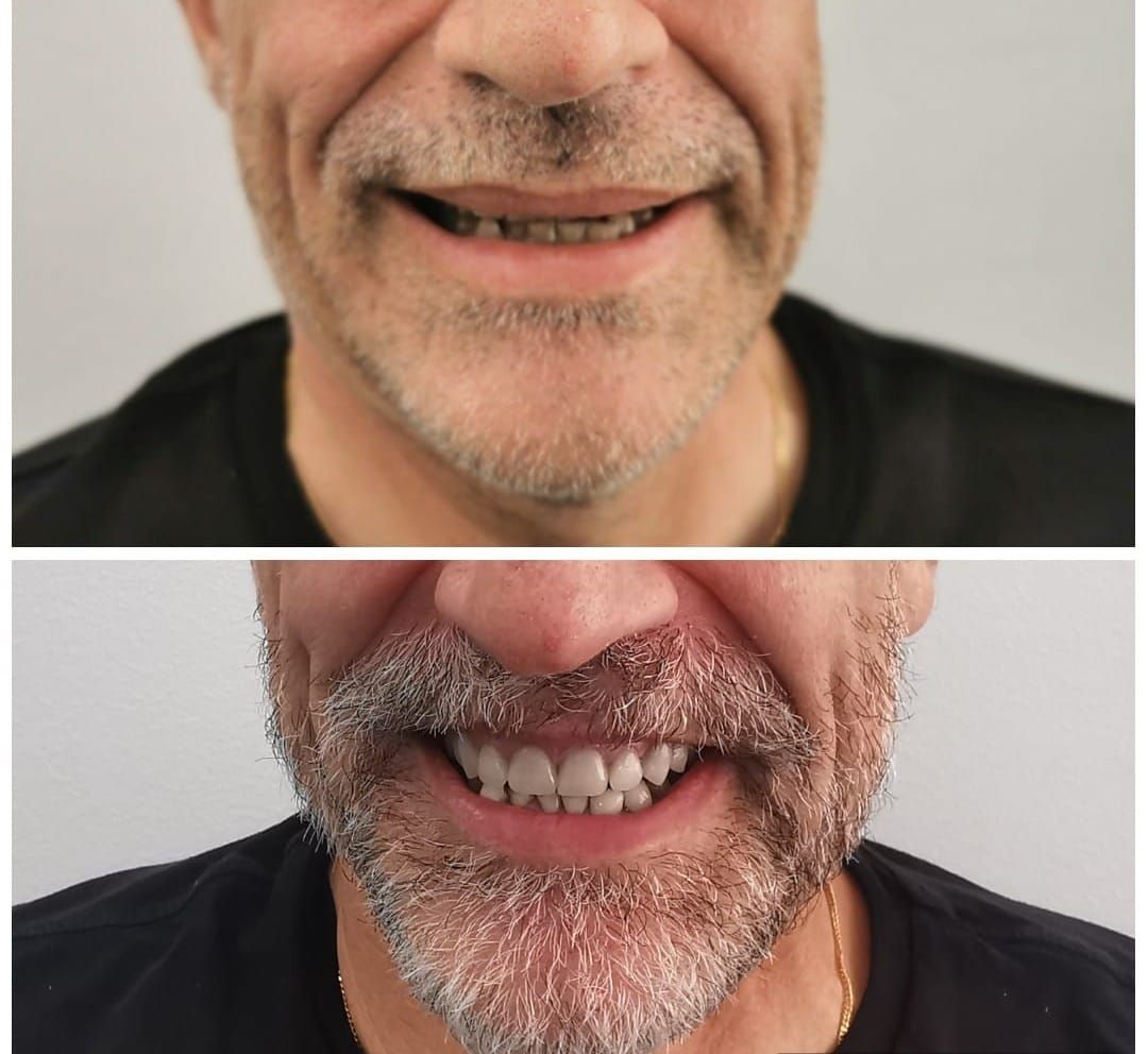 Alba Araujo Alvarez-4