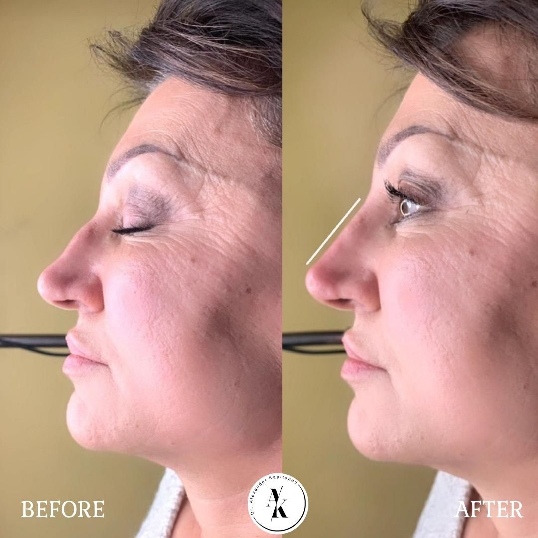 Alexandr Kapitonov-9