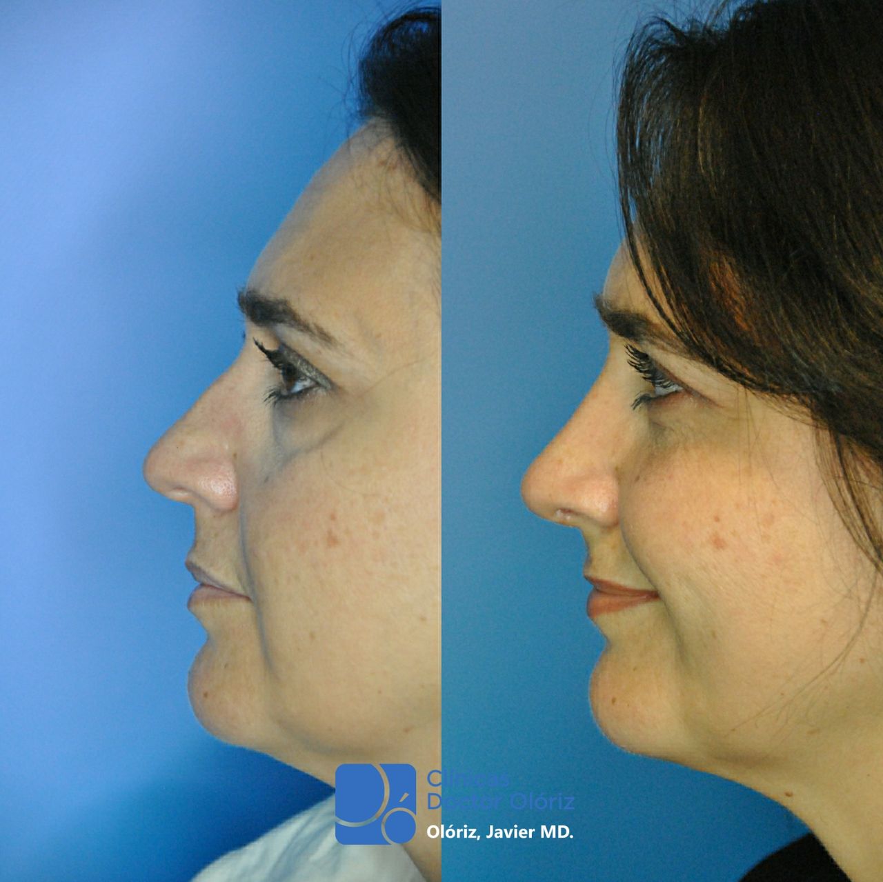 Javier Oloriz Marin-5