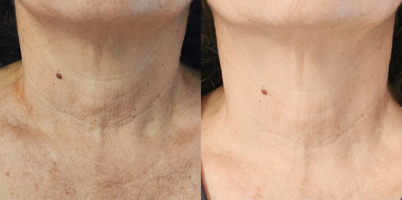 Rosalba Herrero Zerpa-554