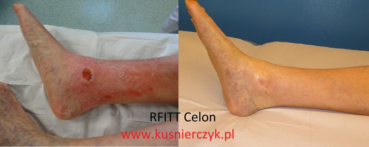 Roman Kuśnierczyk-4