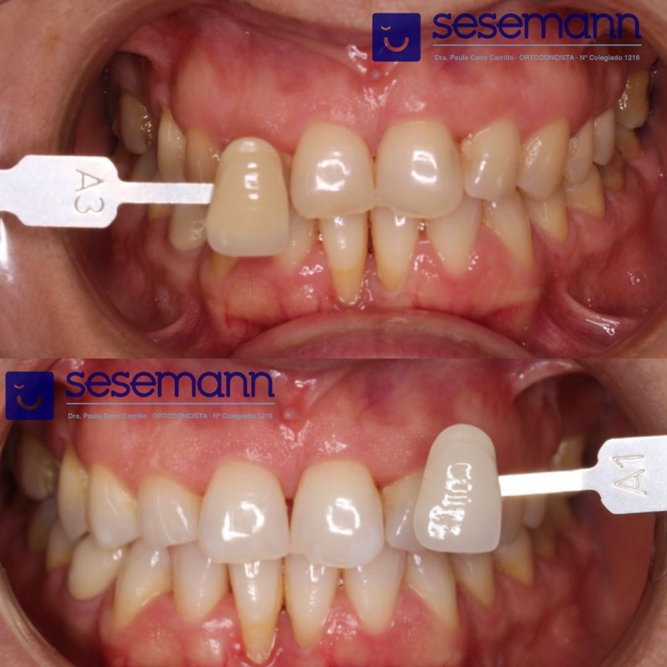 Paula Cano Carrillo-89