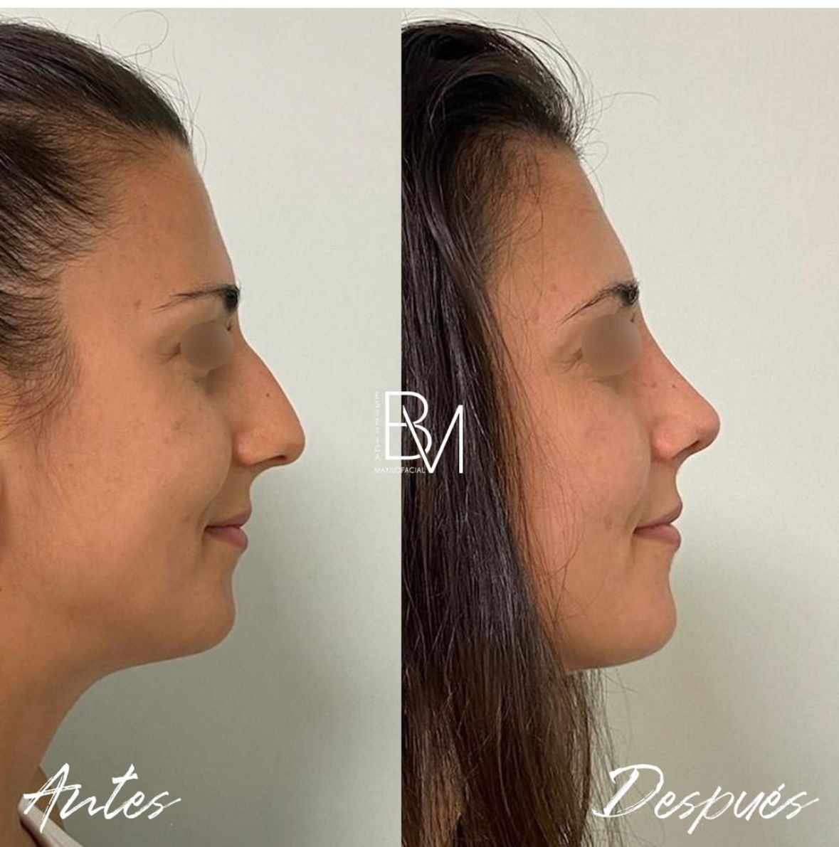 Beatriz Moralejo-51