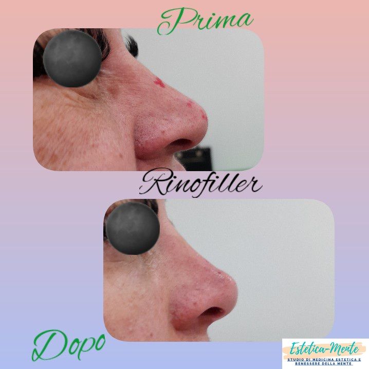 Paola Della Rocca-41