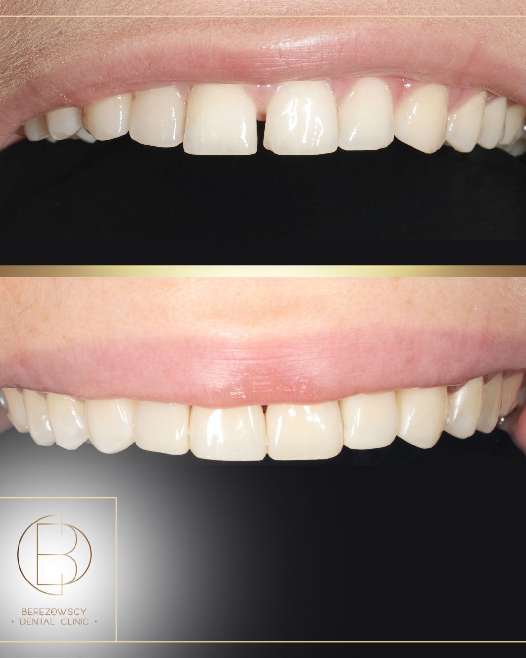 Emilia Gałązka-Tatarczak-2