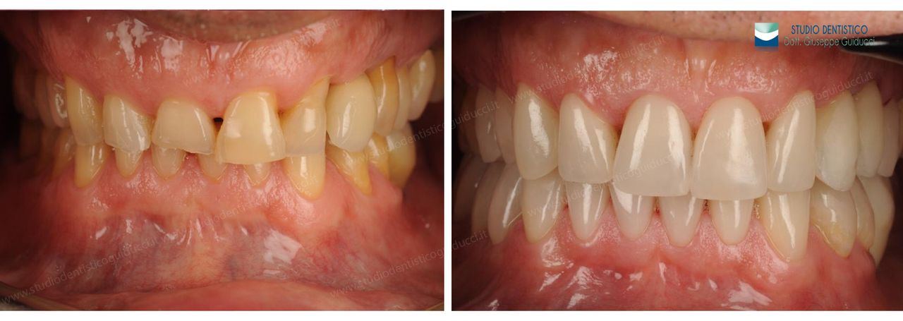 Giuseppe Guiducci-14