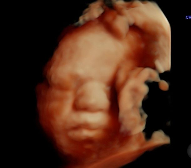 Tommaso Incandela-76