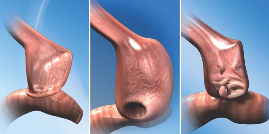 Román Turró Arau-4