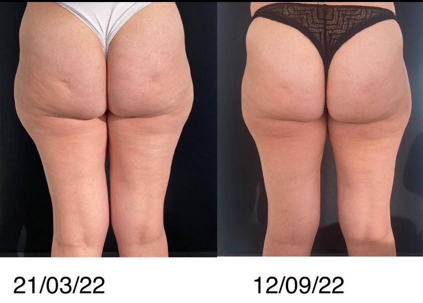 Lazara Dianelys Tamayo-8