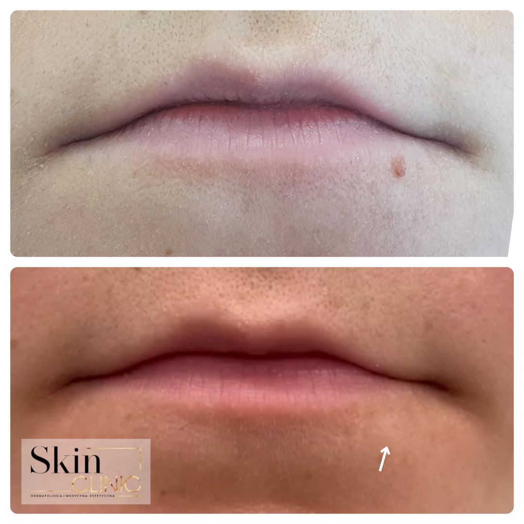 Alina Skrzypek-Salamon-8