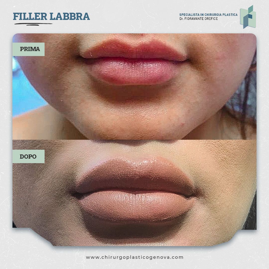 Fioravante Orefice-9