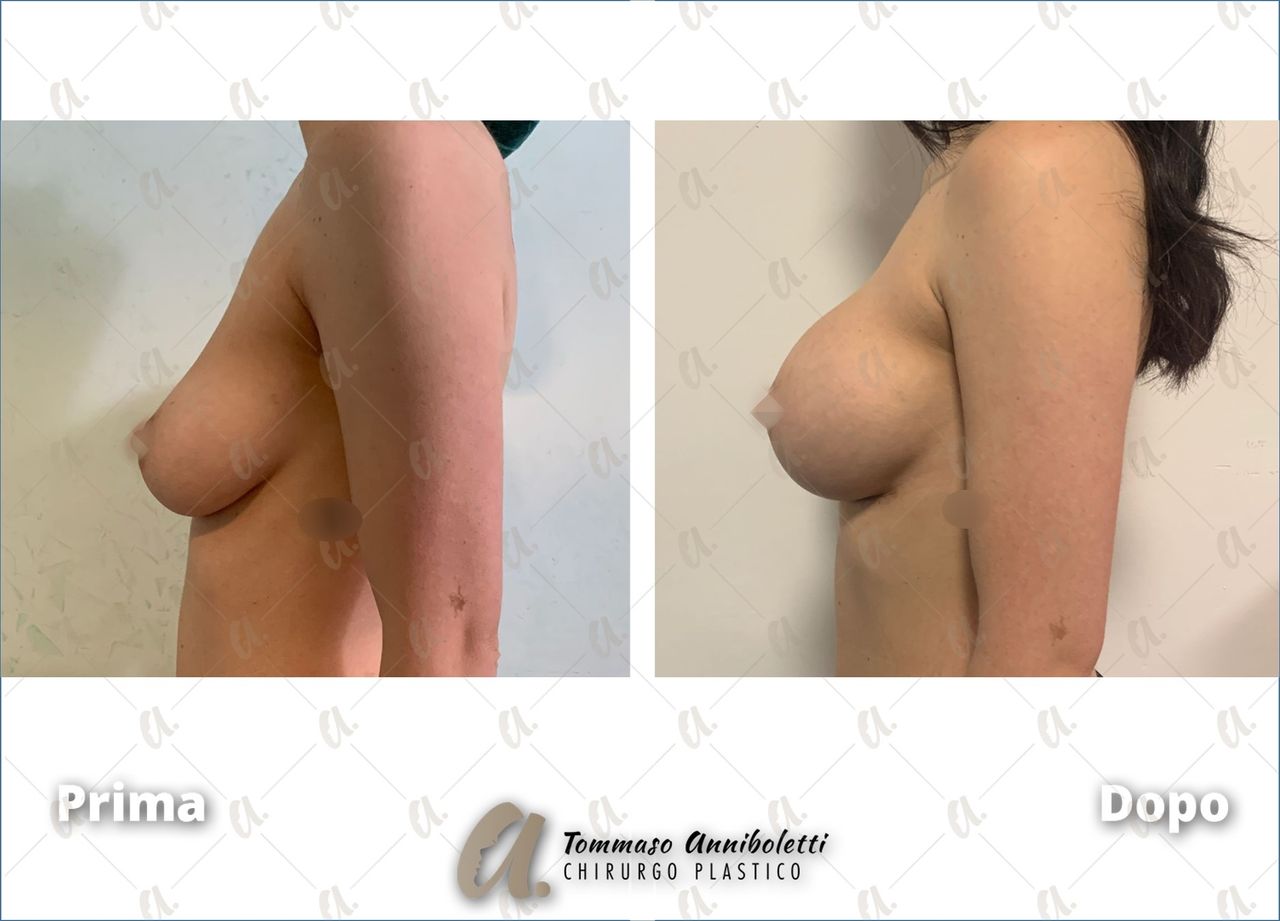 Tommaso Anniboletti-37