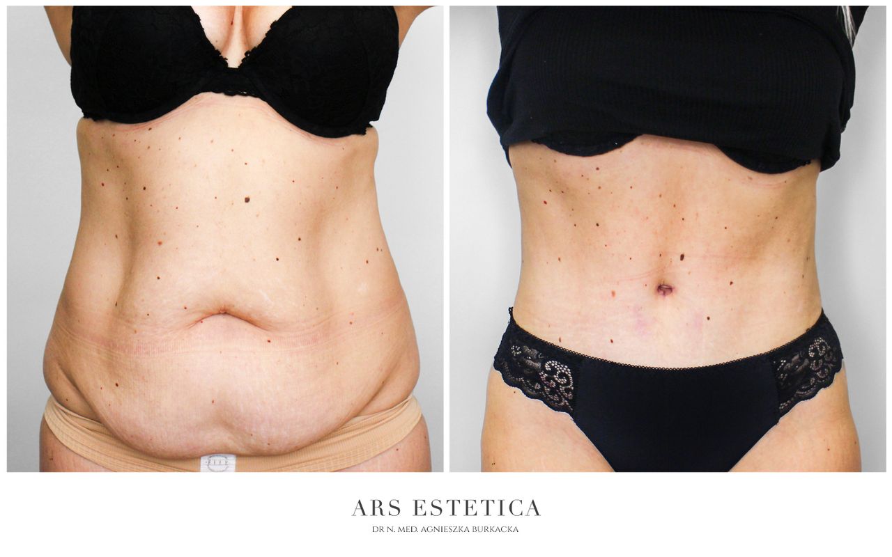 Agnieszka Burkacka-0