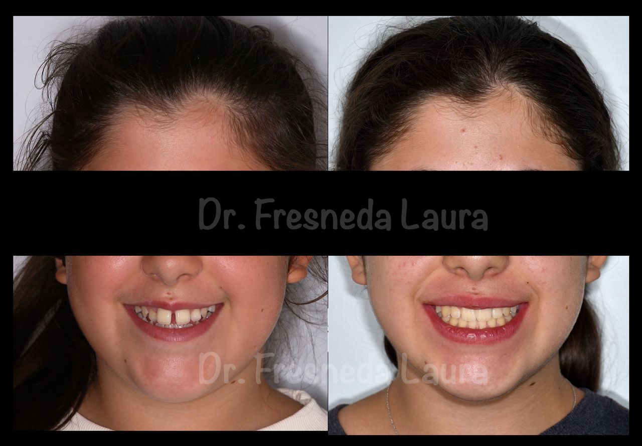 Laura Fresneda Bustos-6