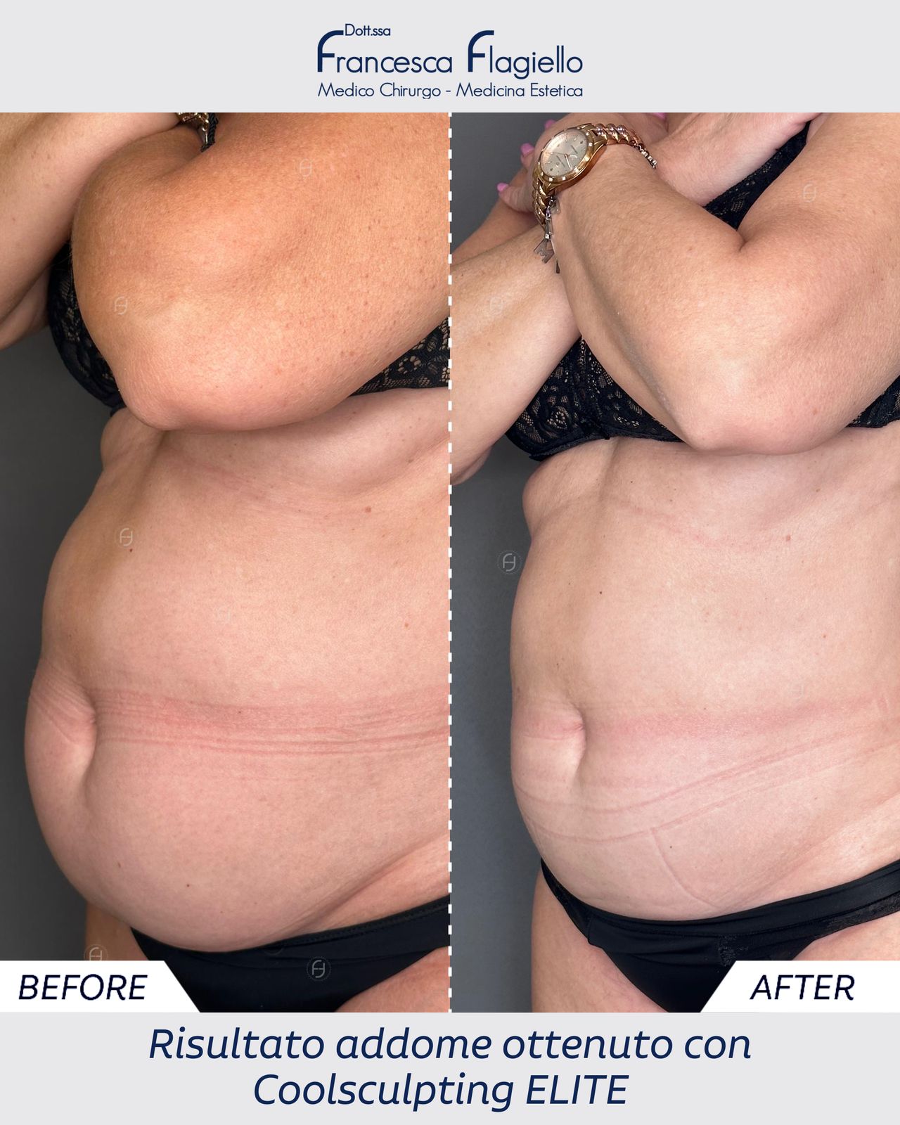 Francesca Flagiello-26