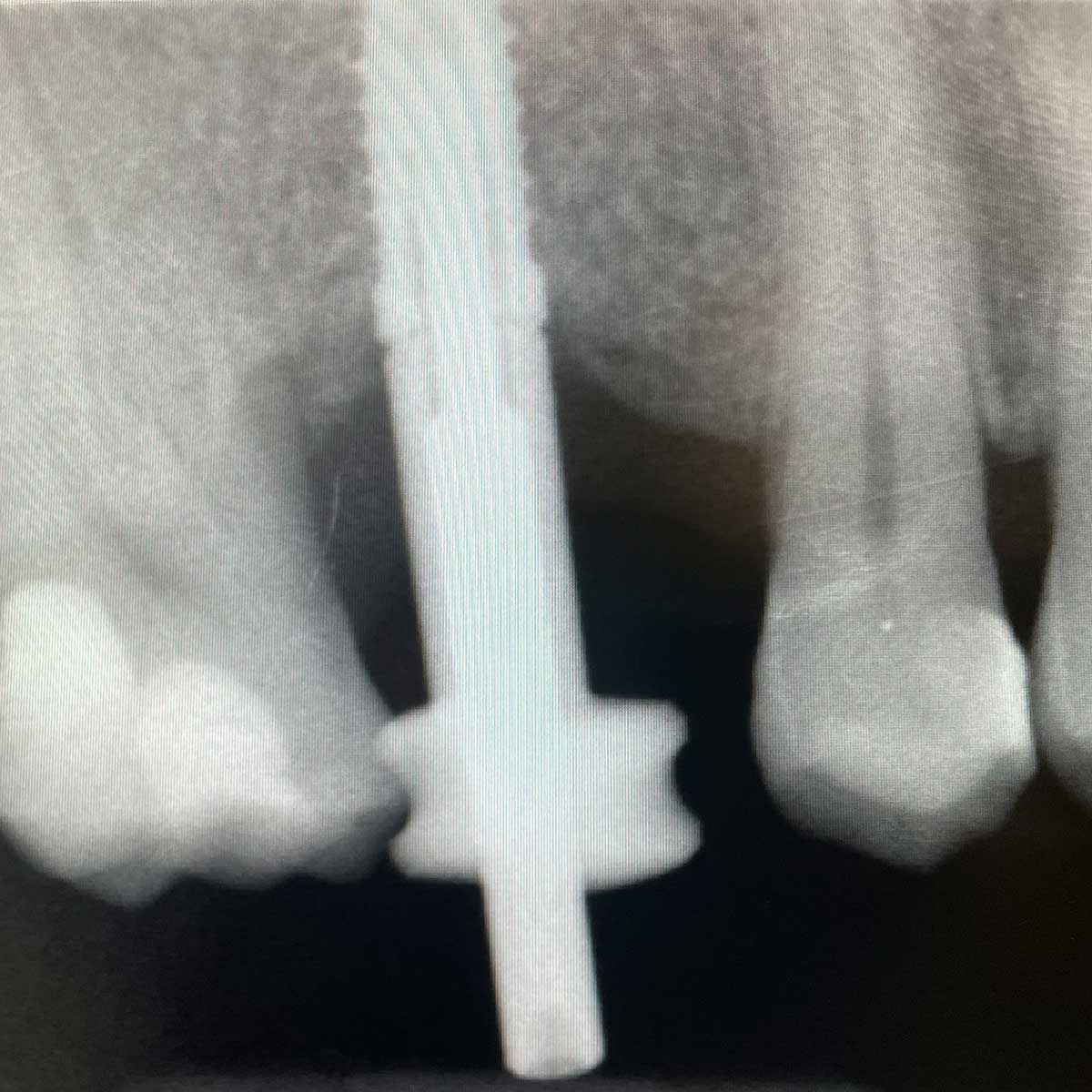 Gianluigi Bittante-81